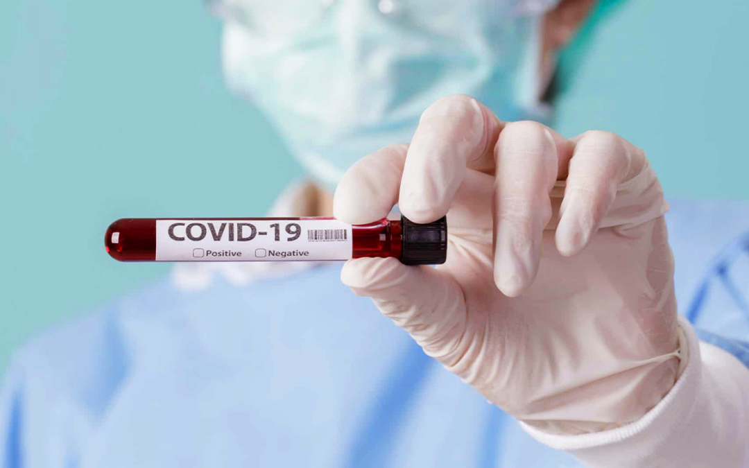 Portaria torna obrigatória notificação de resultados de testes de Covid-19